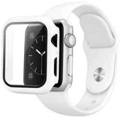 SmartWatcherz Apple Watch Szíj és Tok (Azonos Színben) (49865377972552)