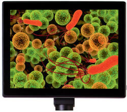 Levenhuk Levenhuk MED 5M digitális mikroszkóp-kamera 9, 4" LCD-kijelzővel (74246)