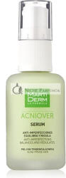 MartiDerm Acniover Szérum, 30 ml