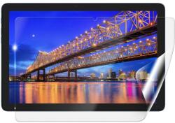 Screenshield IGET Smart W32 FullHD fólia a kijelző védelmére (IGT-SMW32FHD-D)
