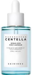 SKIN1004 Arcszérum SKIN1004 Madagascar Centella Hyalu-Cica, Első ampulla, 50 ml (SKIN1004_14)