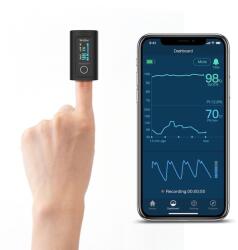 Viatom Bluetoothos Véroxigénszint mérő (Viatom Oxísmart Bluetooth Fingertip Oximeter HM-60FW)