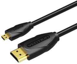 Vention VAA-D03-B100 HDMI kábel 1 M HDMI D-típus (Micro) HDMI A-típus (Standard) Fekete (VAA-D03-B100)