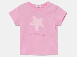 Benetton baba pamut póló rózsaszín, 3I1XA1069 - rózsaszín 82 - answear - 5 290 Ft