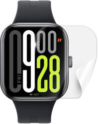 ScreenShield XIAOMI Redmi Watch 5 védőfólia (XIA-REDWA5-D)