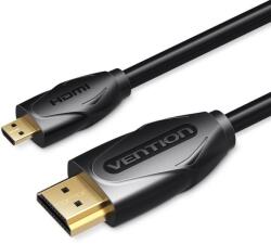 Vention Micro HDMI to HDMI Cable 1M Black (VAA-D03-B100)