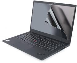 StarTech Anti-Glare Privacy Screen 17.3" (16: 9) (173L-PRIVACY-SCREEN)