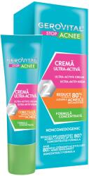 Gerovital Stop Acnee Ultra-aktív krém, 15 ml