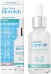Bye Bye Blemish Skin Rescue szérum, 30 ml