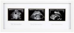 Pearhead - Rama foto pentru ecografii (PHP63016)