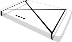 XR Brands Interlace Bed Restraint Set
