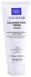 Duepunti Cremă antieroșeață Martiderm, Calamină, 75 ml