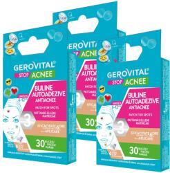 Gerovital Stop Acne ajándékcsomag: Öntapadós pattanás elleni pöttyök, 30 darab + Öntapadós pattanás elleni pöttyök, 30 darab + Öntapadós pattanás elleni pöttyök, 30 darab