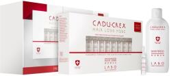 CADU-CREX Hair Loss HSSC Serious Hair Loss hajkúra súlyos mértékű hajhullás ellen takarékos kiszerelés
