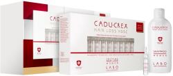 CADU-CREX Hair Loss HSSC Advanced Hair Loss hajkúra előrehaladott állapotú hajhullás ellen takarékos kiszerelés