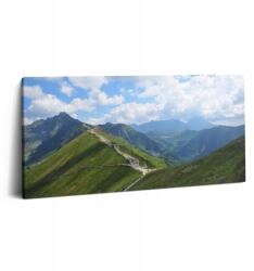 Wallfluent Fotó Vászonkép Konyha Tartós Fali Kasprowy Wierch Zakopane 100x50 (010030010010000075614)