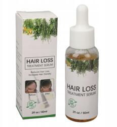  Rozmaringyos Hajnövesztő Olaj 60ML (HINID8989)