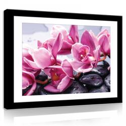 Consalnet Vászonkép, Orchidea és zen kövek, 100x75 cm méretben (C5-11305O1)