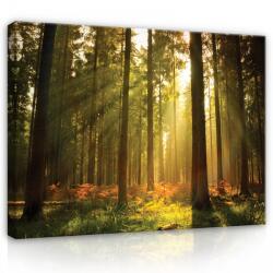 Consalnet Vászonkép, Napfényes erdő, 120x80 cm méretben (C5-204O20)
