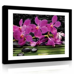 Consalnet Vászonkép, Orchideák 80x60 cm méretben (C5-11307O6)