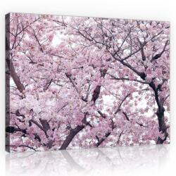 Consalnet Vászonkép, Cseresznyefa, 100x75 cm méretben (C5-10894O1)