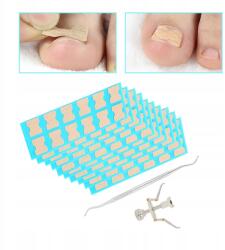  120DB Csíkos Tapaszok Korrekciós Tapaszok Benőtt Köröm Láb Pedikűr (308929)