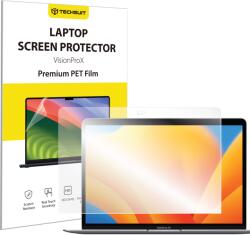 Techsuit MacBook Air 13" (2018/2017/2020) Clear Techsuit - VisionProX Anti-Blue Light