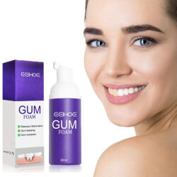Eelhoe ínyápoló és fehérítő hab - 60 ml (eelhoe_gum)