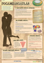 Stiefel Fogamzásgátlás - fali oktatótabló - stiefelbolt - 26 800 Ft