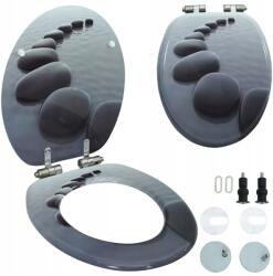 vidaXL WC ülőke, kő mintás, lassan záródó, MDF, állítható (STONES)