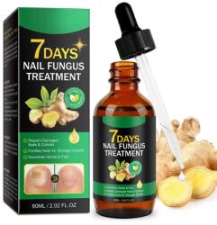 Nova Kiss Körömgomba kezelés gyömbérrel, serkenti a regenerációt és a növekedést, NOVA KISS®, 60 ml