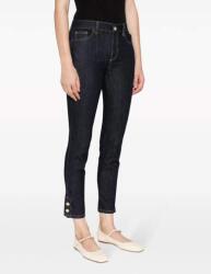 Liu Jo Fekete Cipzáras Farmernadrág (30/28) (590953)