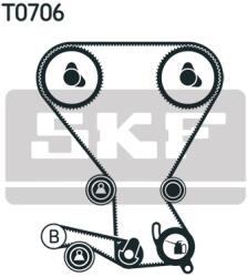 SKF Set Curea De Distributie Vkma95659 Hyundai H-1/H-1 / Starex/Santa Fé I/Sonata Iv