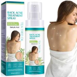 NOVA KISS Spray Antiacneic pentru Spate si Corp cu Ingrediente Naturale - Reduce Cosurile si Excesul de Sebum, 120 ml