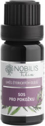 Nobilis Tilia SOS illóolajkeverék, bőrre, 10 ml
