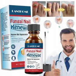  Gombaellenes körömlakk, erős javítás, gyengéd ápolás, 10ml (Grzybica paznokci Silny Płyn Do Naprawy)