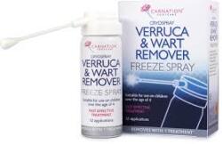 Carnation footcare szemölcsfagyasztó spray 50 ml - menteskereso