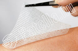 LOMATUELL kenőcstüll 5x5 cm steril 10x 23314