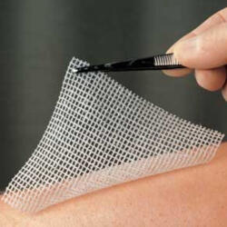 LOMATUELL kenőcstüll 10x10 cm (410054576)