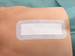 HARTMANN Cosmopor e steril sebfedő 10 cm x 6 cm (szigetkötszer hartmann) 25 db/doboz (17915)