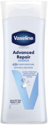 VASELINE Testápoló VASELINE Advanced Repair száraz és repedezett bőrre 400ml (65486233)