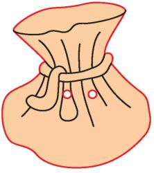 Penta collection Fafigura gomb 35 - erszény 10 db/csomag