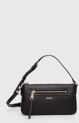 DKNY keresztpántos táska női bőr - fekete Univerzális méret - answear - 64 990 Ft
