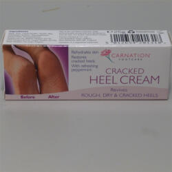 Carnation sarokbőr simító krém 50 g - freefrom