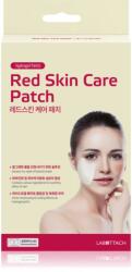 Wooshin Labottach Red Skin Care Patch hidrogél tapaszok bőrpírra az arcbőr megnyugtatására 2 pár