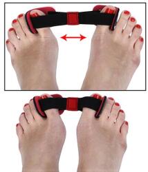 UNIZDRAV Hallux Valgus korrekciós eszköz