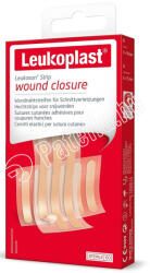 Leukoplast steril leukosan strip sebzáró 9x 7995103 - plazapatika