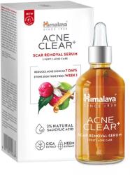 Himalaya Acne Clear pattanások utáni hegeltávolító szérum - 30ml ( Kiszerelés: 30ml )
