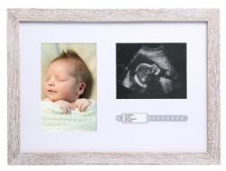 Pearhead Rama foto pentru ecografie si bratara din maternitate Pearhead (PH87097)