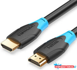 Vention HDMI-A ( aktív, fekete), 30m, kábel (AAMBT)